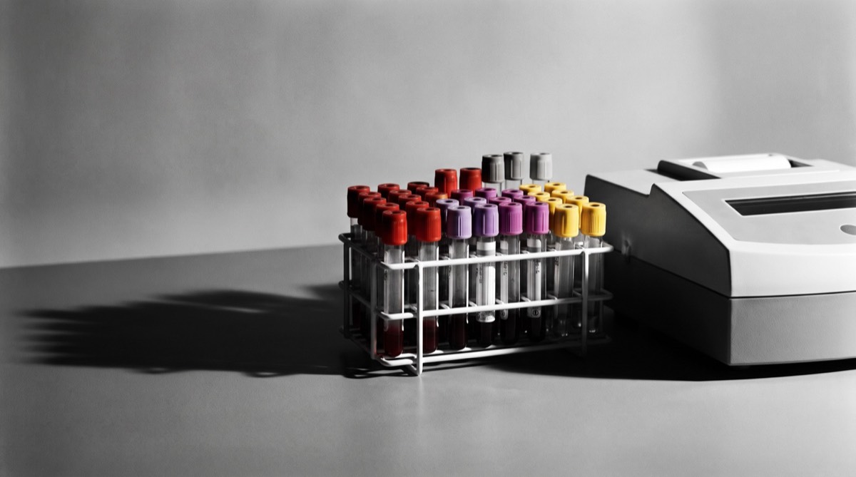 Blood test tubes in a rack beside a laboratory analyser (illustrative image)